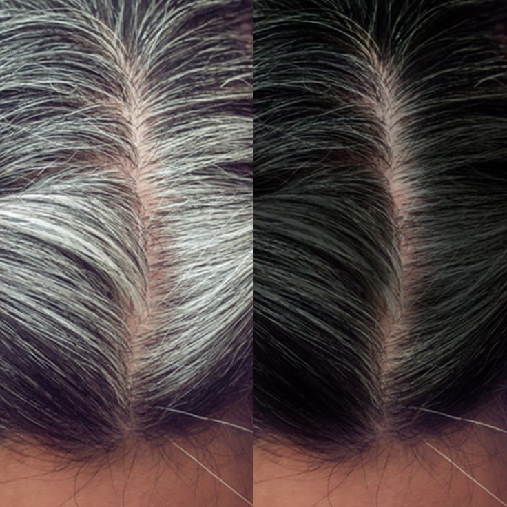 Hair Building Fiber | ألياف تكثيف الشعر الفورية
